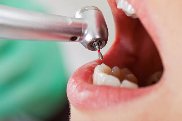 Best Walk-In Emergency Dentist in Loch Sheldrake, NY